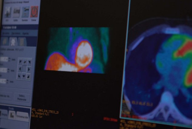 PET scan of chest